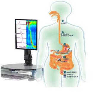 <font color=red>胃腸</font>動力學檢查系統 Solar GI 