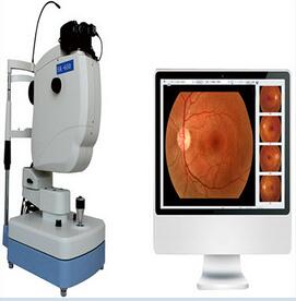 眼底照相機