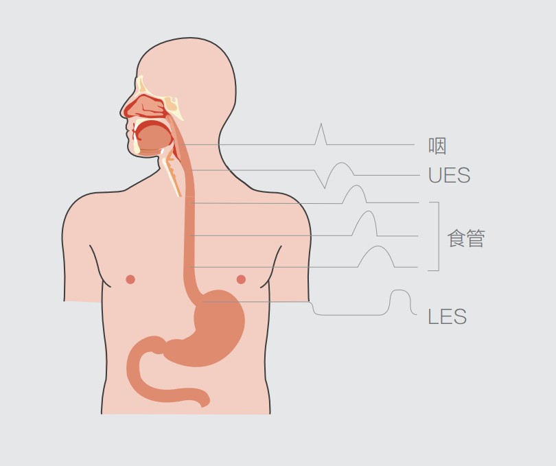 吞咽神經肌肉低頻電刺激儀