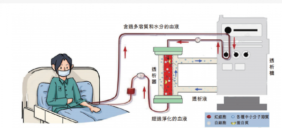 費森尤斯血液透析機：改善生活，重塑未來