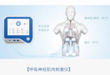 呼吸神經肌肉刺激儀的特點|優勢