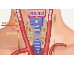 喉返神經監測儀的優缺點分析-甲狀腺外科設備