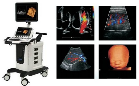 超聲診斷系統
