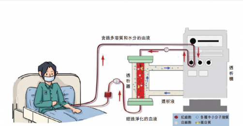 了解血液透析機的工作原理、裝置特點及應用