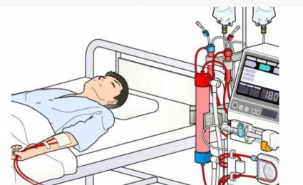 了解血液透析機器的工作原理、外觀和結構