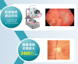 TNF506 數碼眼底照相機-高清影像質量的專業醫療設備